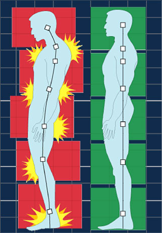 Posture & Pain Chart
